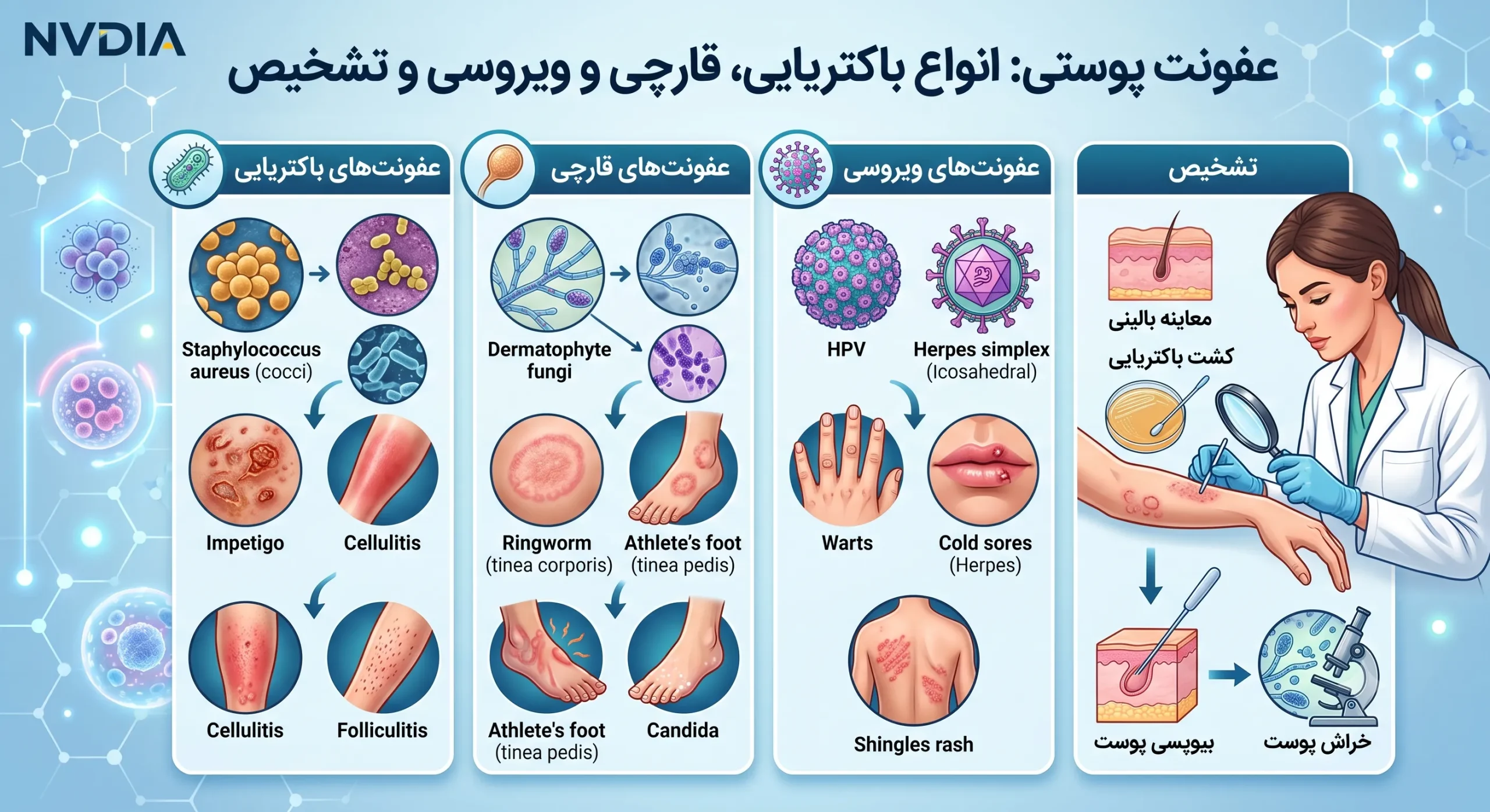 عفونت پوستی